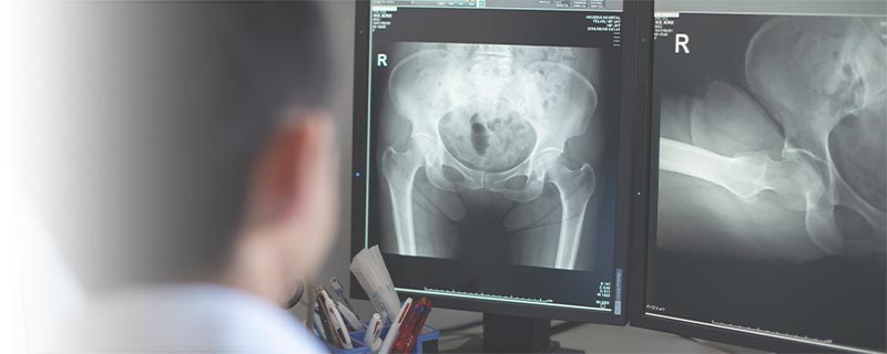 股関節疾患 福岡豊栄会病院