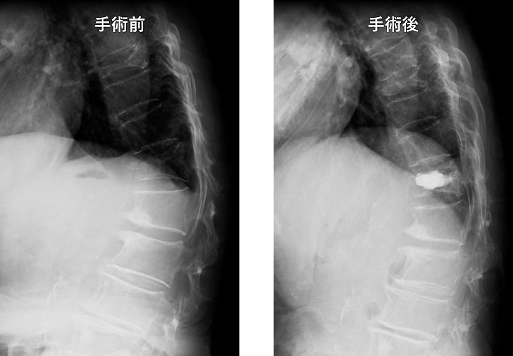 脊椎疾患